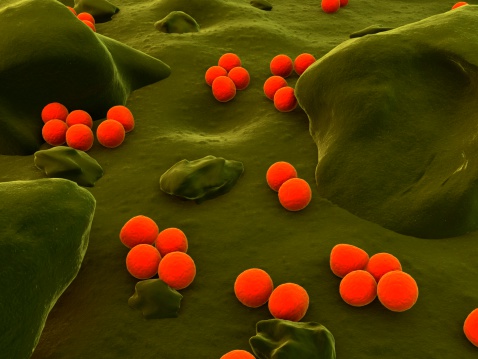 The coccus bacteria known as neisseria meningitidis can cause meningitis. 