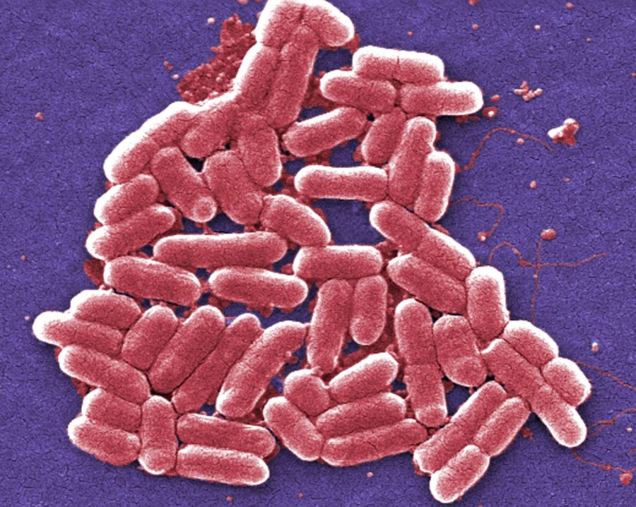 E.+coli